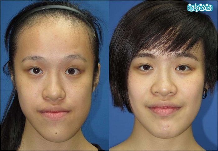 علل و درمان ناهنجاری فک و صورت