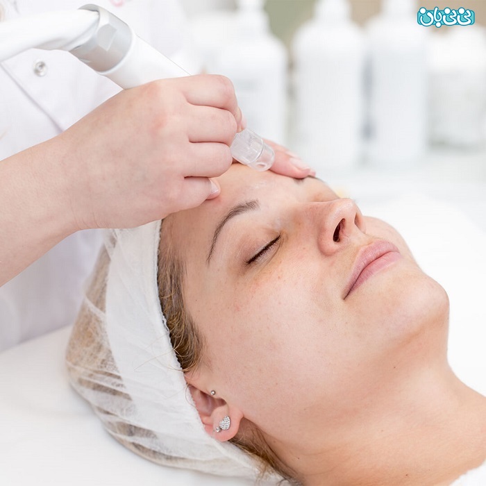 مزایای میکرودرم ابریژن