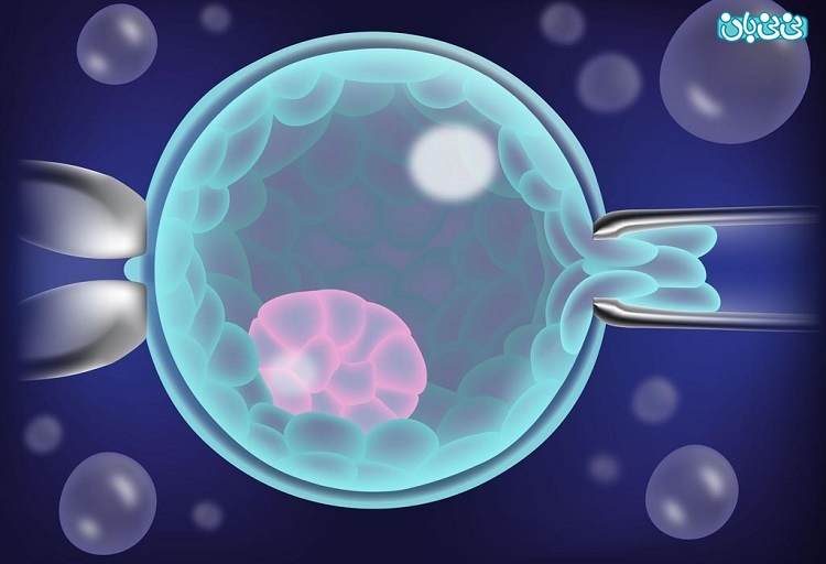 تست ژنتیکی پیش از لانه گزینی (PGD/PGT) چیست؟