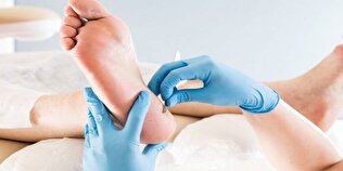 یک روش عجیب برای درمان زخم‌های دیابت