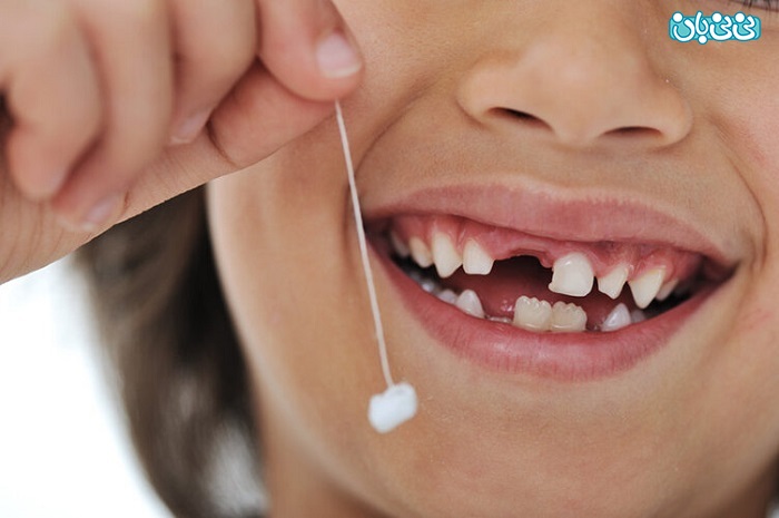 جدول زمانی درآمدن و افتادن دندان های کودک ترتیب افتادن دندان شیری