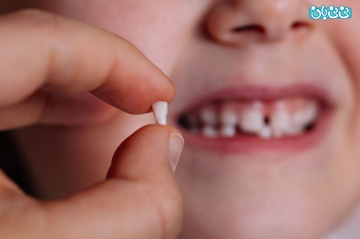 دندان شیری کودک
