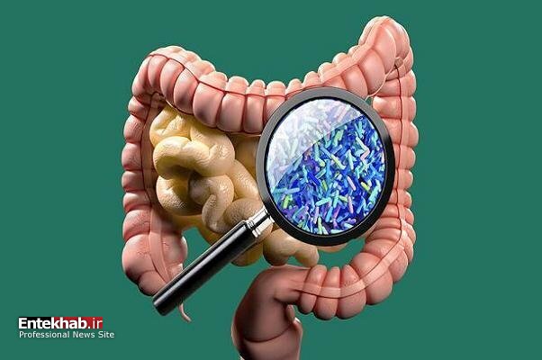افزایش نرخ ابتلا به سرطان روده در افراد جوان