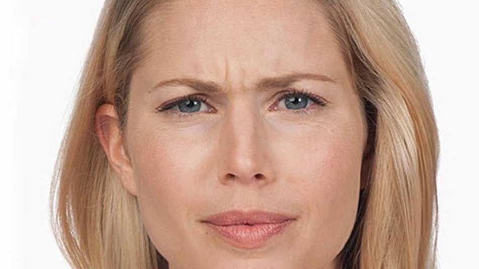 تکنیک‌هایی برای از بین بردن خط اخم بدون بوتاکس