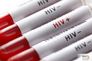 ویروس HIV از چه راههایی منتقل می شود؟+اینفوگرافیک