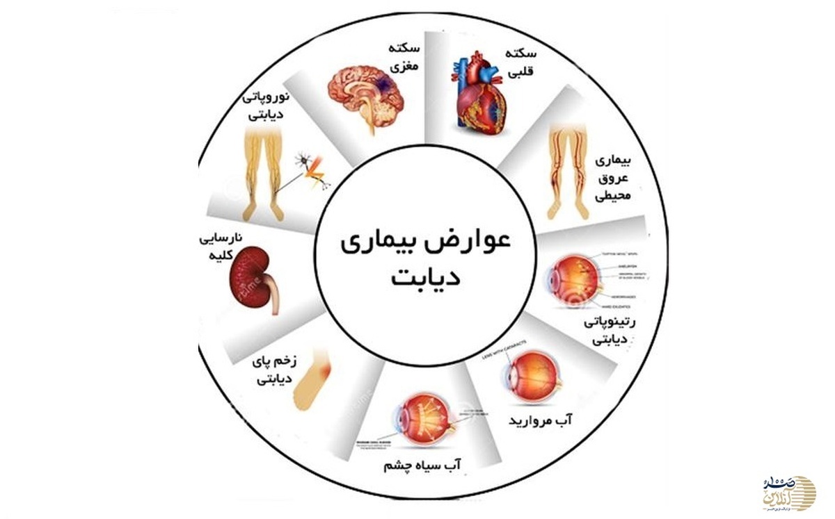 روش درمان قطعی دیابت و بیماری قند خون در طب سنتی ایران + ویدئو