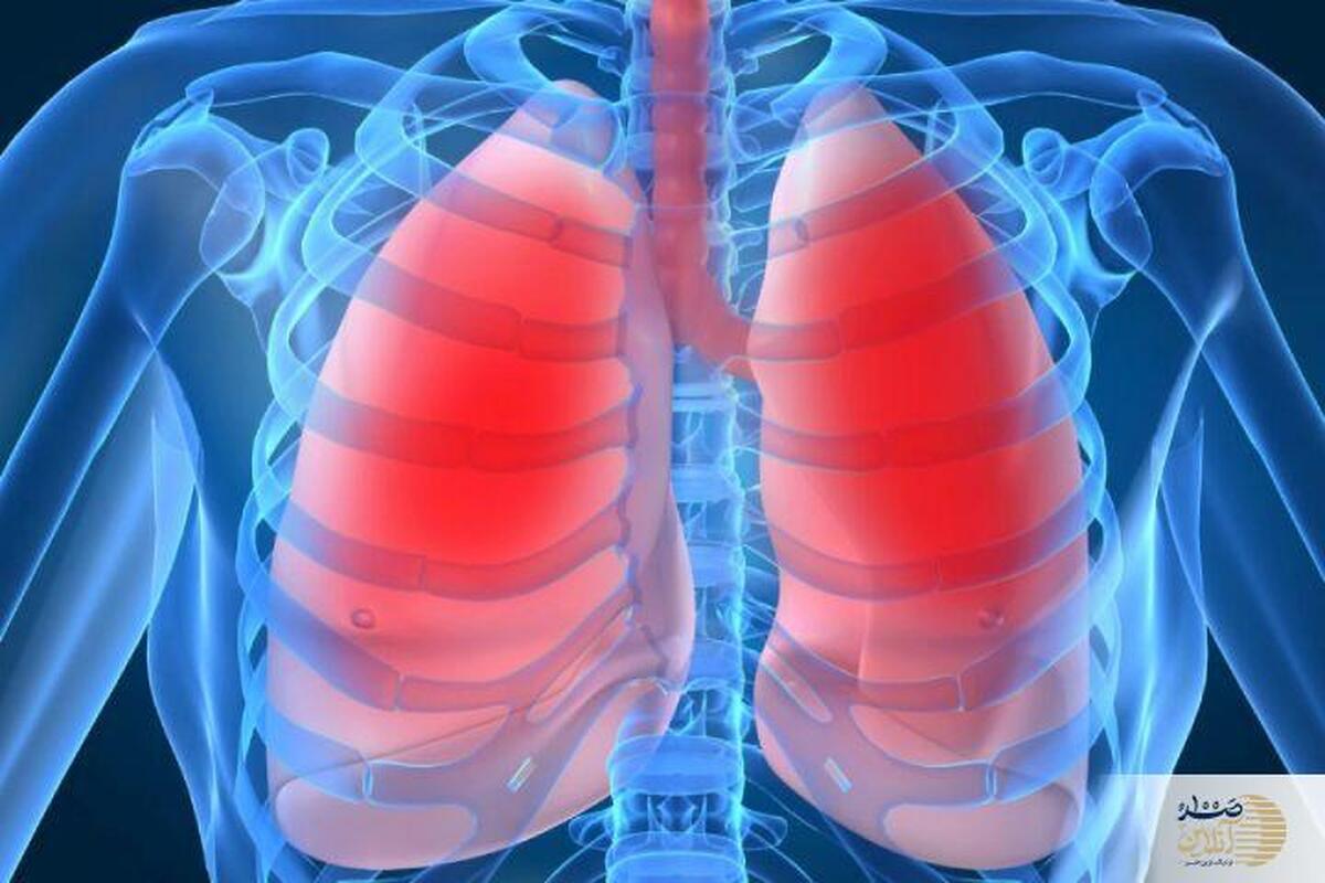 این عوامل باعث آسم می شود + علائم آسم