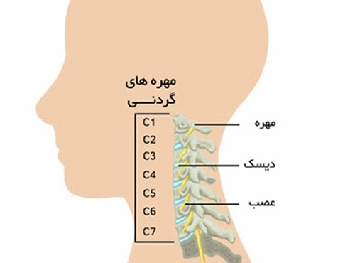 دیسک گردن را با این ورزش‌ها درمان کنید (صبح من)