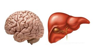بلایی که مشکلات کبد سر مغزتان می آورد