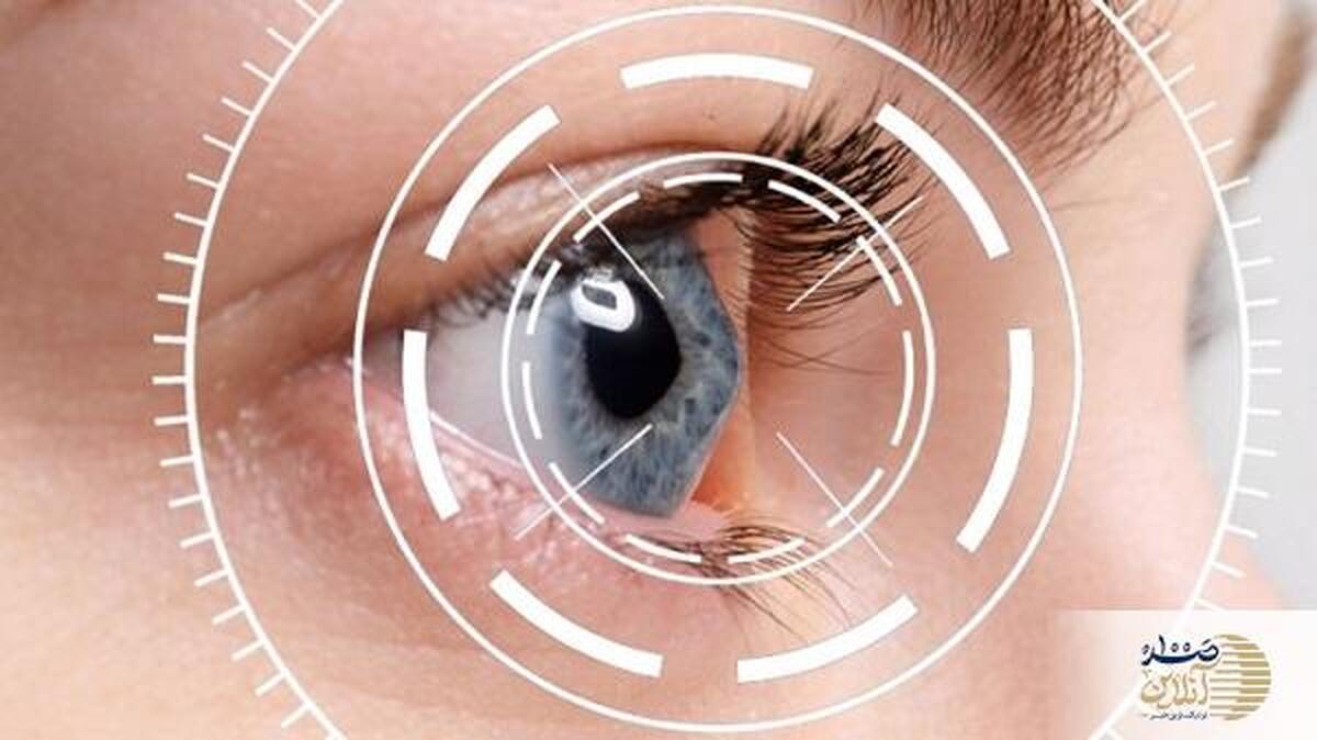 نحوه جلوگیری از عفونت‌های چشمی