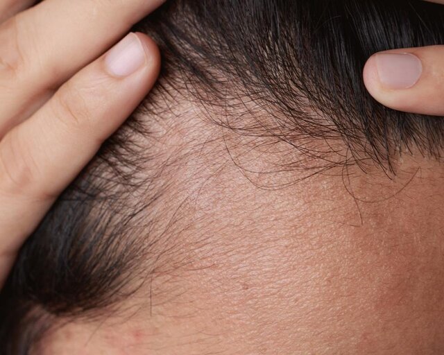 چگونه از آسیبدیدگی موها پیشگیری کنیم؟ چگونه از آسیبدیدگی موها پیشگیری کنیم؟