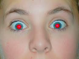 قرمزی مردمک چشم در عکس‌ها نشانه بیماری است؟