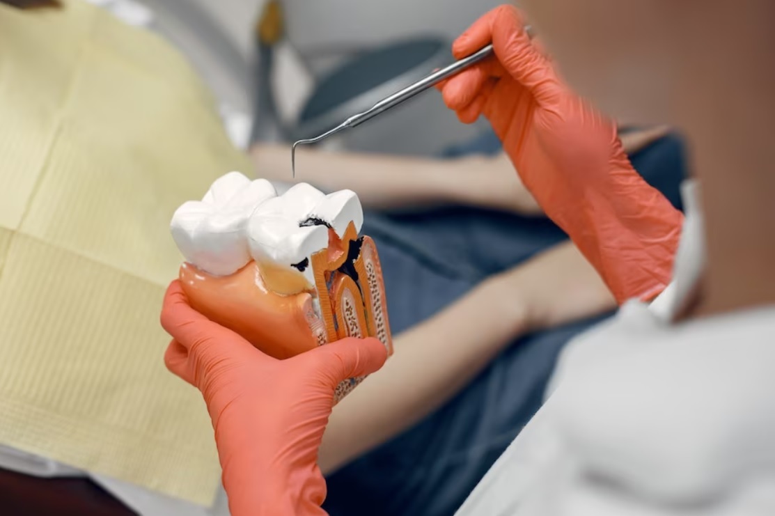 دندانپزشکی ترمیمی و انواع آن