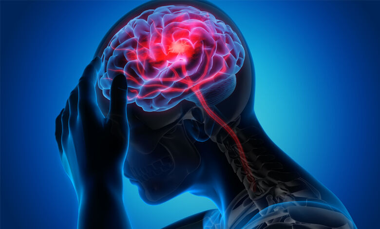 راهنمایی جدید برای شناسایی علائم سکته مغزی