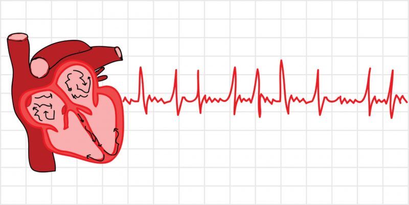 تاثیر استاتین در کاهش ریسک سکته در مبتلایان فیبریلاسیون دهلیزی