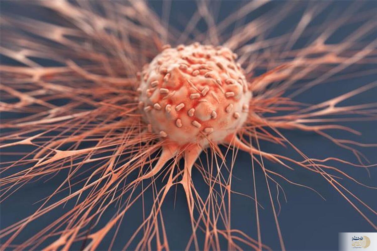 سرطان در کمین این زنان | احتمال سونامی سرطان‌های زنان
