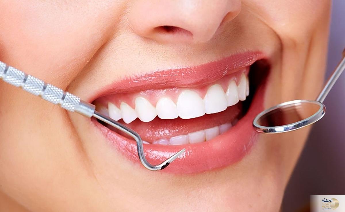 روش پزشکی و روش خانگی سفید کردن دندان