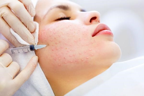 چگونه جای زخم کهنه را از بین ببریم؟