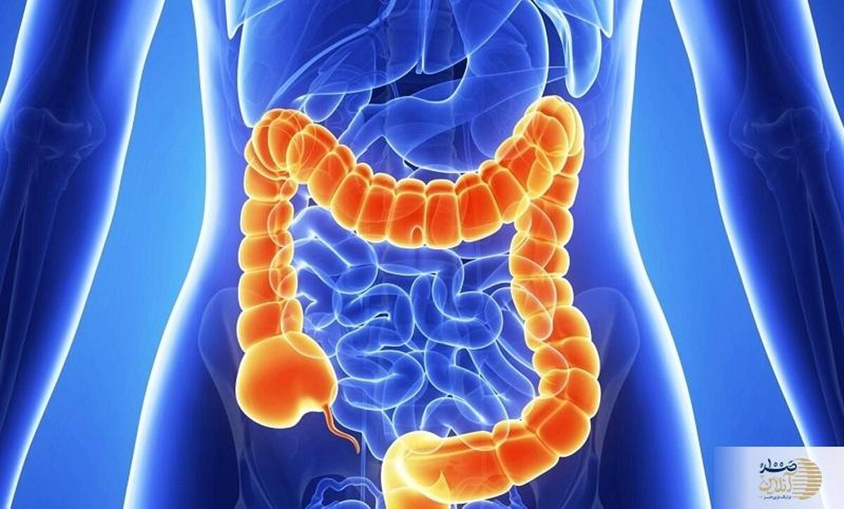 مراقب روده هایتان باشید تا این بیماری ها سراغتان نیاید