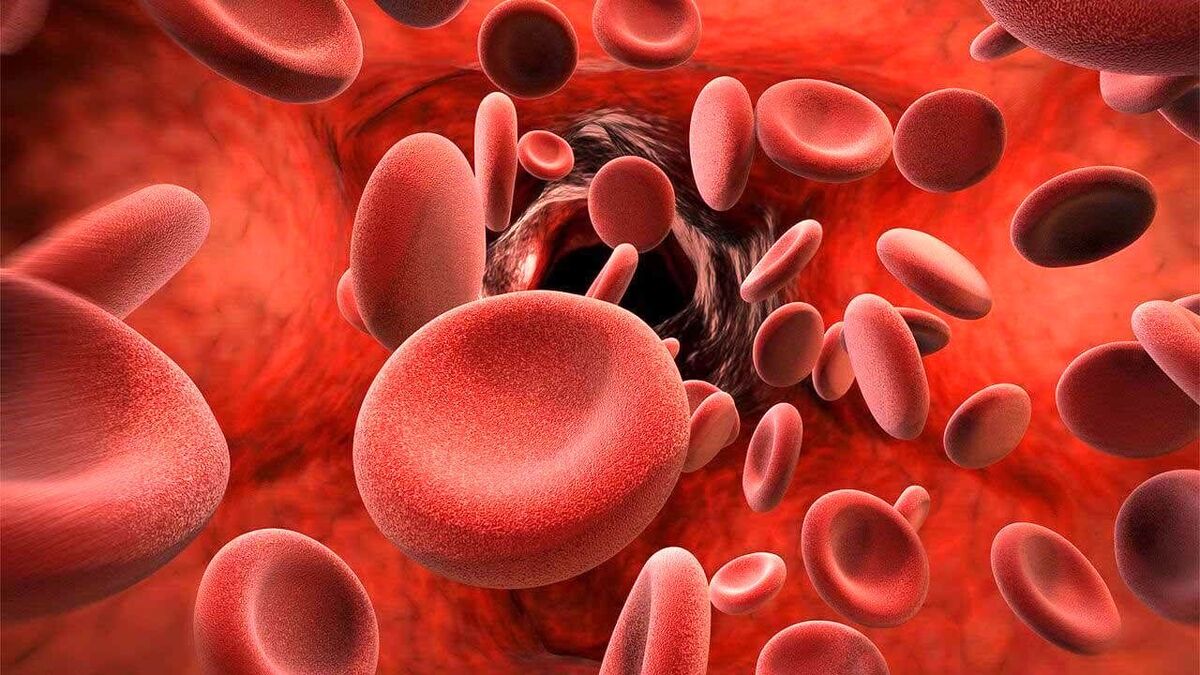 نشانه‌ها و انواع شایع کم خونی را بشناسید