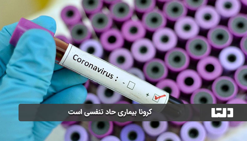 کوید 19 همچنان وجود دارد