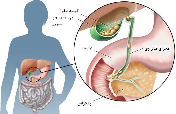 کیسه صفرا در کجا قرار دارد؟ کار آن چیست؟ (روزیاتو)