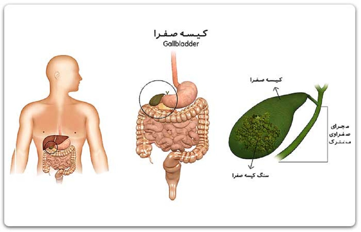 کیسه صفرا در کجا قرار دارد؟ کار آن چیست؟ (روزیاتو)
