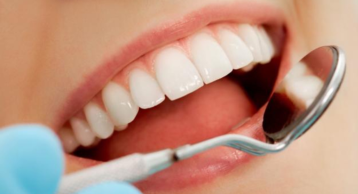 بهترین سن برای جراحی دندان عقل را بدانید