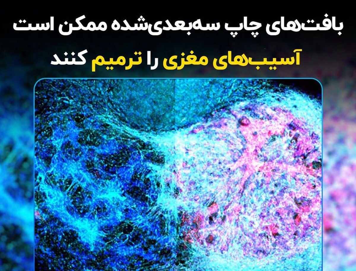 بافت‌های چاپ سه‌بعدی‌شده ممکن است آسیب‌های مغزی را ترمیم کنند