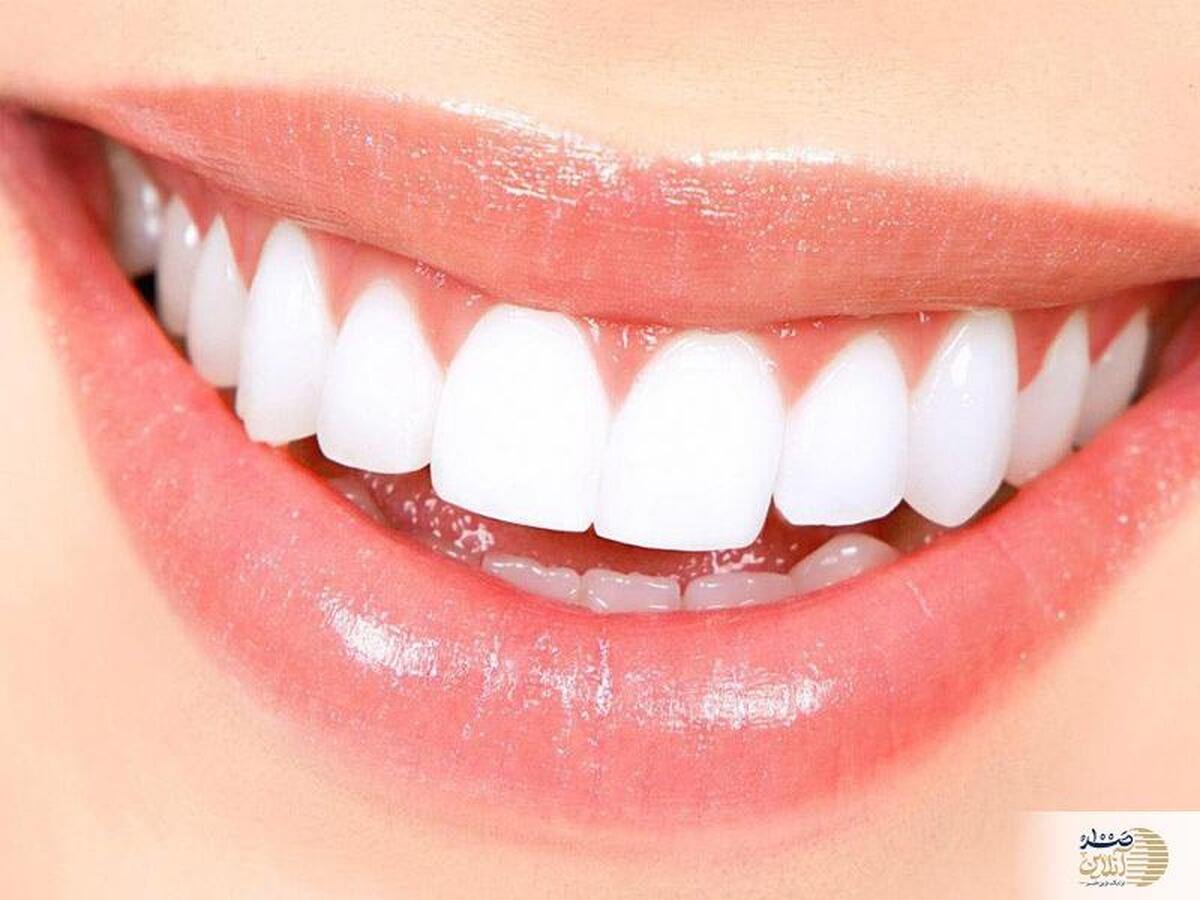 دلیل اصلی پوسیدگی دندان از داخل