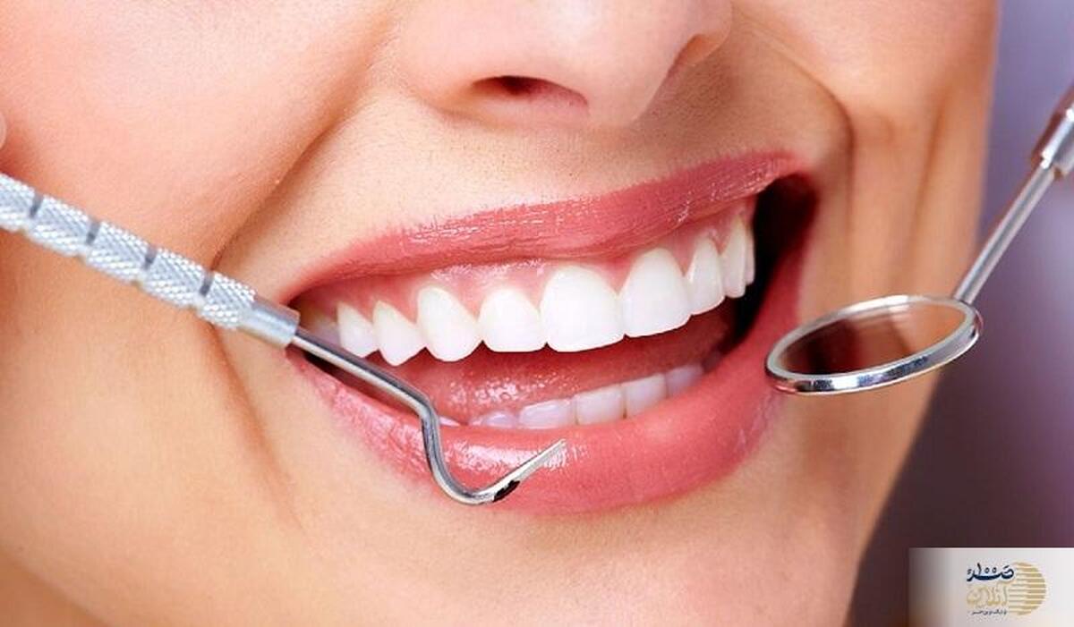 محققان کشورمان روش جالبی برای سفید کردن دندان پیدا کردند