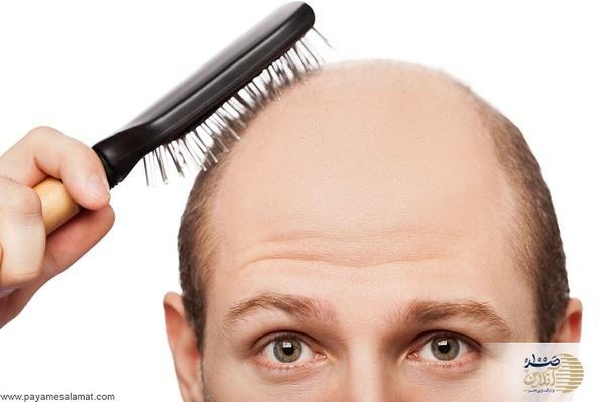 بهترین روش توقف ریزش مو
