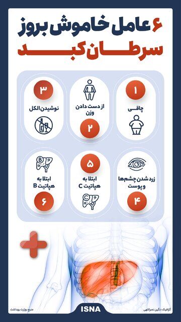 اینفوگرافیک/ ۶ عامل خاموش بروز سرطان کبد