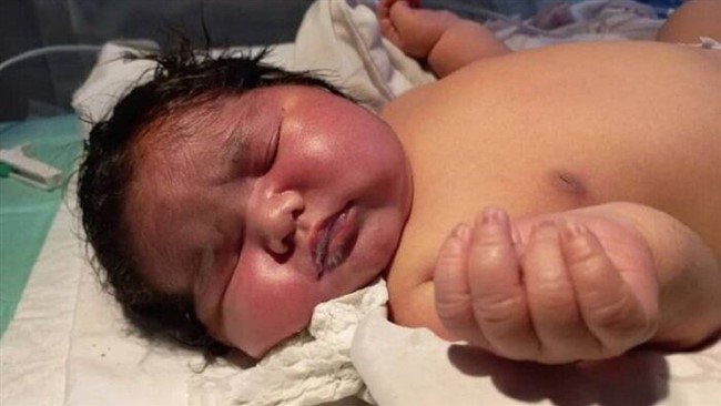 شوکه شدن پزشکان با تولد نوزاد ۷ کیلویی در مشهد