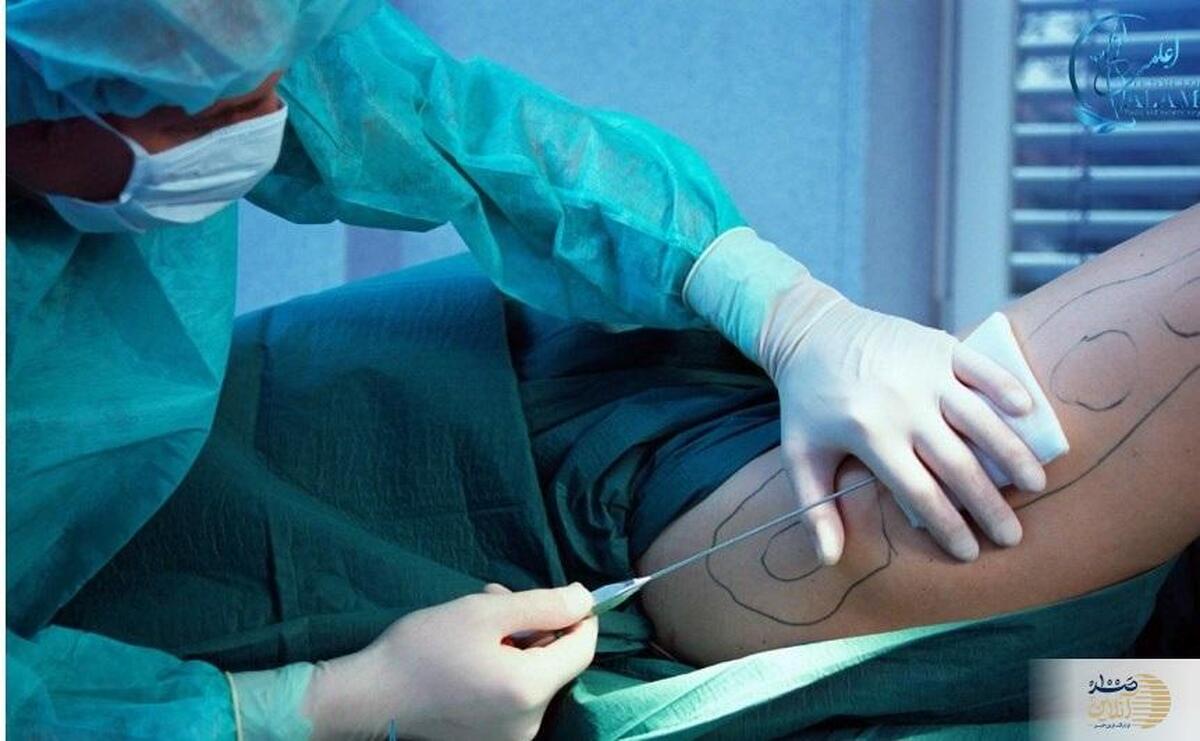 تا عید نوروز با روش طبیعی 8 میوه پیکرتراشی کنید