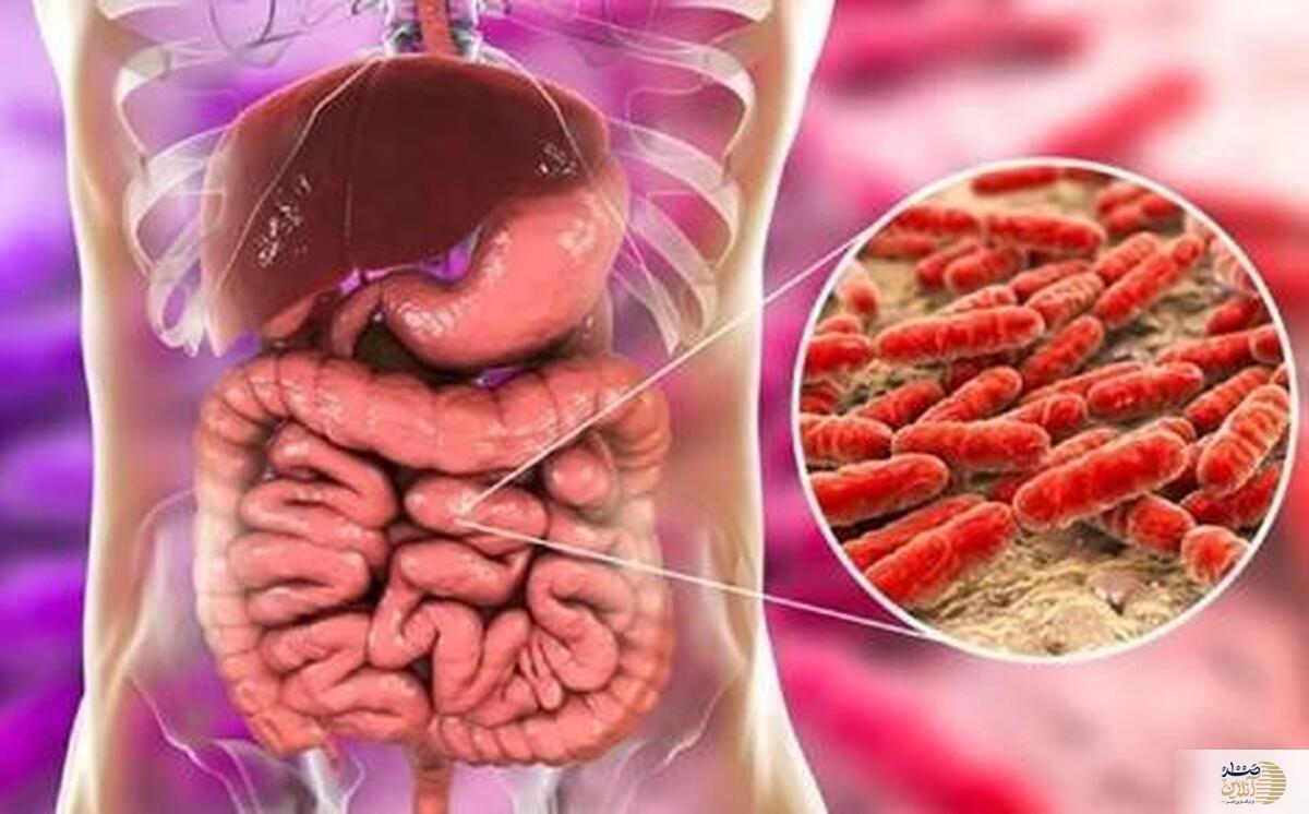 این میان‌ وعده‌ قاتل سرطان روده است