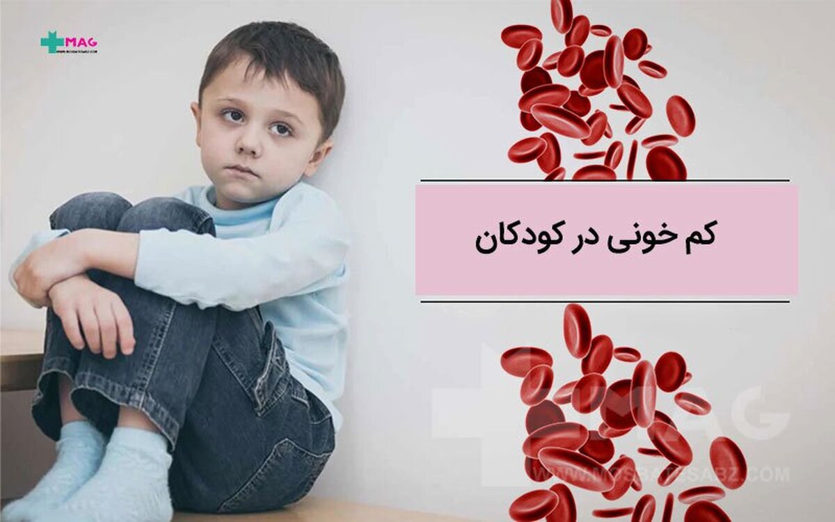 روش‌های درمان و پیشگیری از کم خونی در کودکان