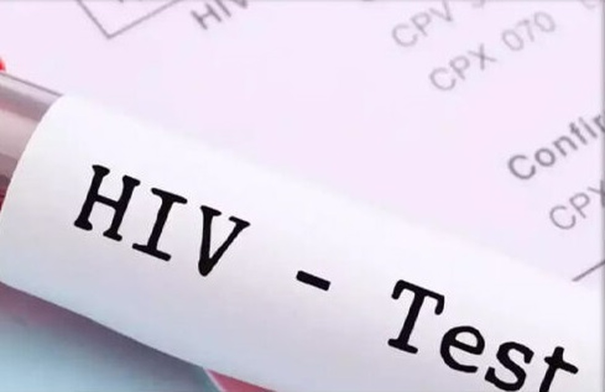 آیا HIV به صورت طبیعی درمان می شود؟