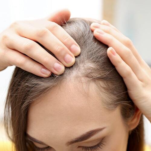 علت ریزش موها چیست؟ علت ریزش موها چیست؟