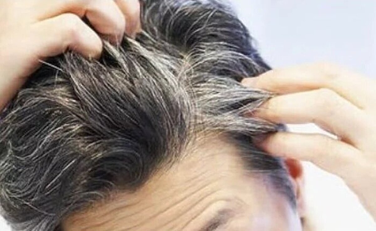 کندن موهای سفید خطر ابتلا به زخم و عفونت را افزایش میدهد کندن موهای سفید خطر ابتلا به زخم و عفونت را افزایش میدهد