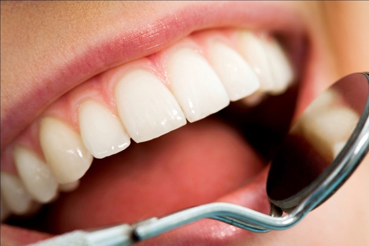 علت این بیماری های خطرناک پوسیدگی دندان است