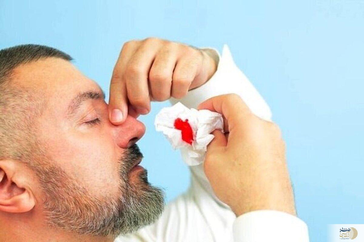 خونریزی بینی در گرما و چند توصیه