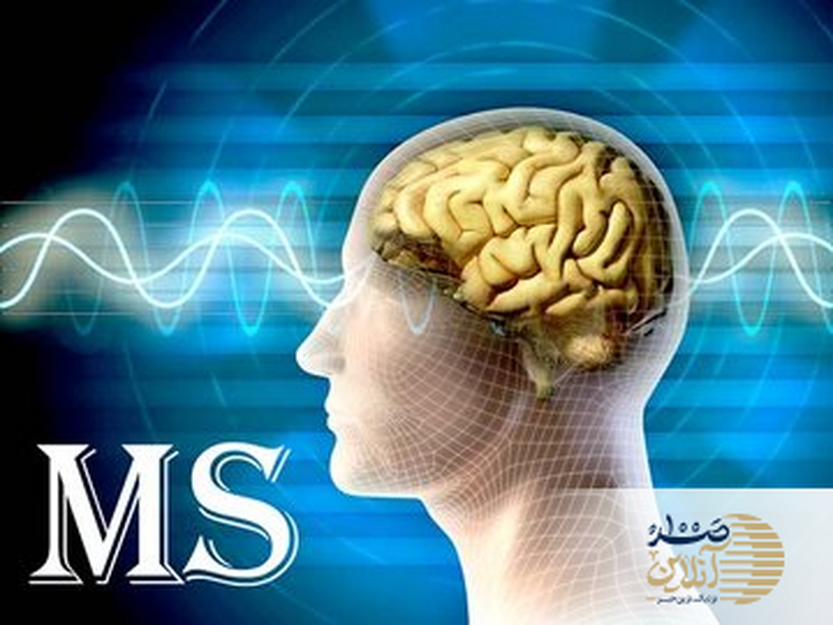 این ۱۰ علامت عجیب ممکن است نشان‌دهنده MS باشند، بی‌خبر نمانید!