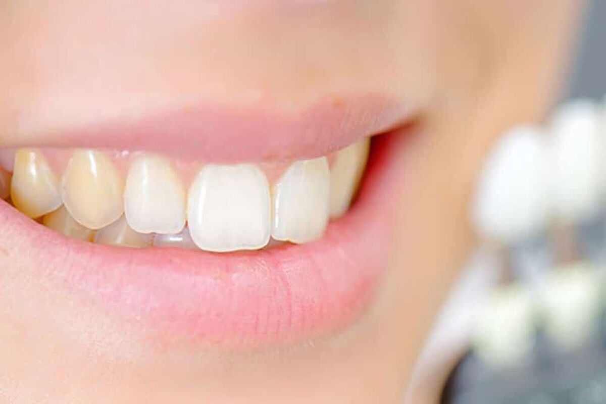 برای دندان درد این قرص را مصرف نکنید