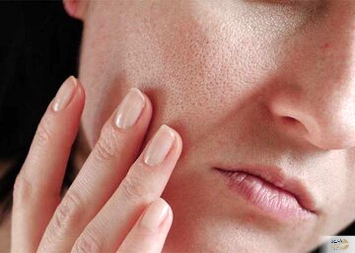 این ویتامین صورت تان را چاق می کند