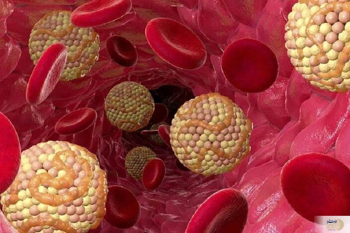 علایم چربی خون بالا که تا الان نشنیده بودید
