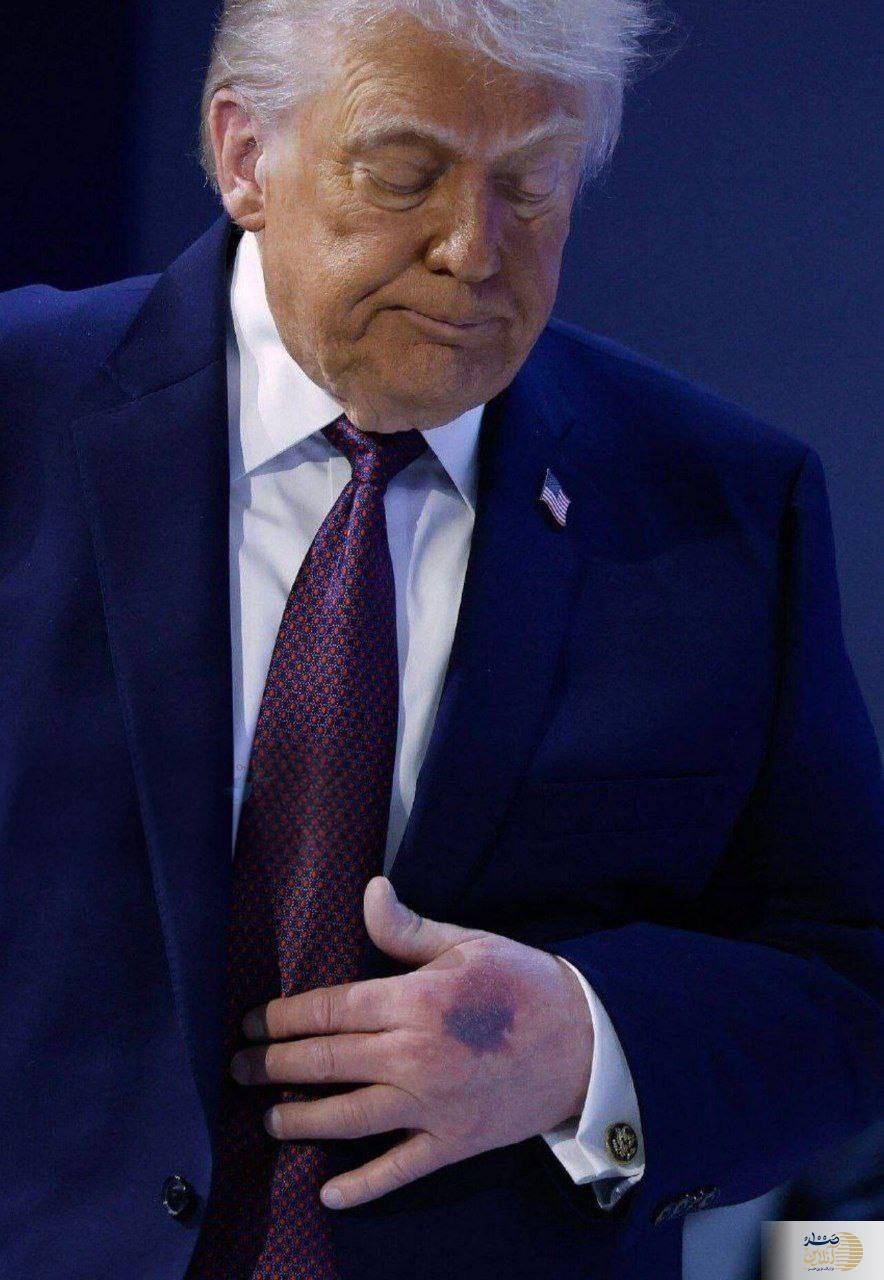 عکسدست ترامپ در اجلاس داووس پربازدید شد