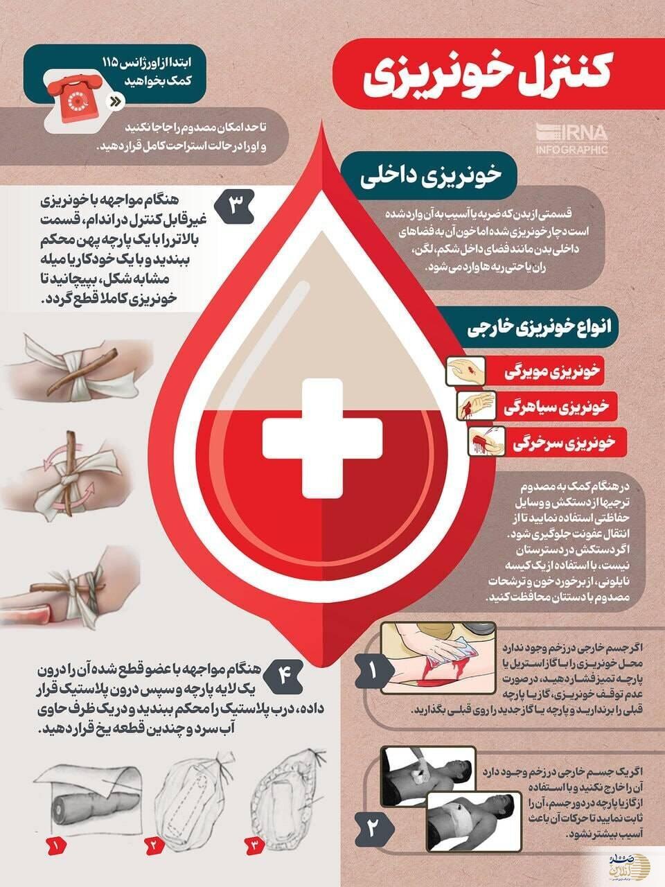 با این راه حل ها در جنگ خونریزی را کنترل کنید