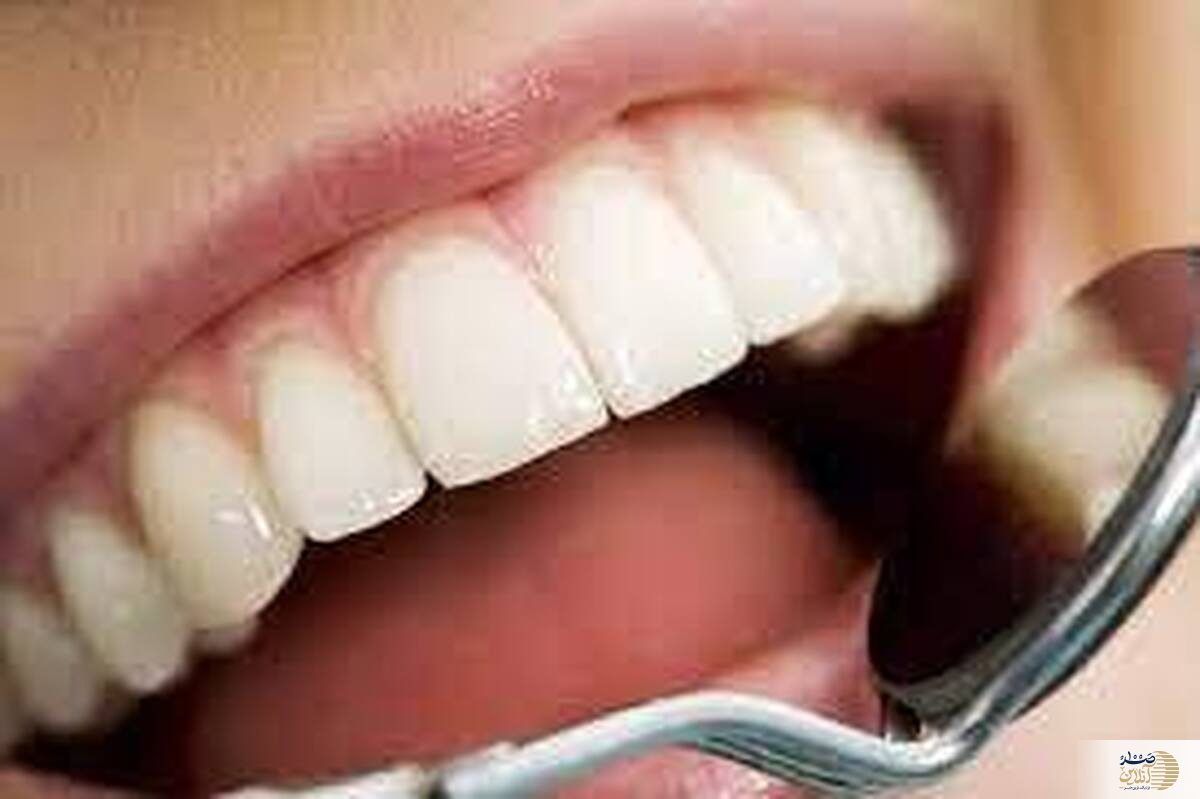 گیاهان دارویی مفید برای درمان بیماری‌های دهان را بشناسید