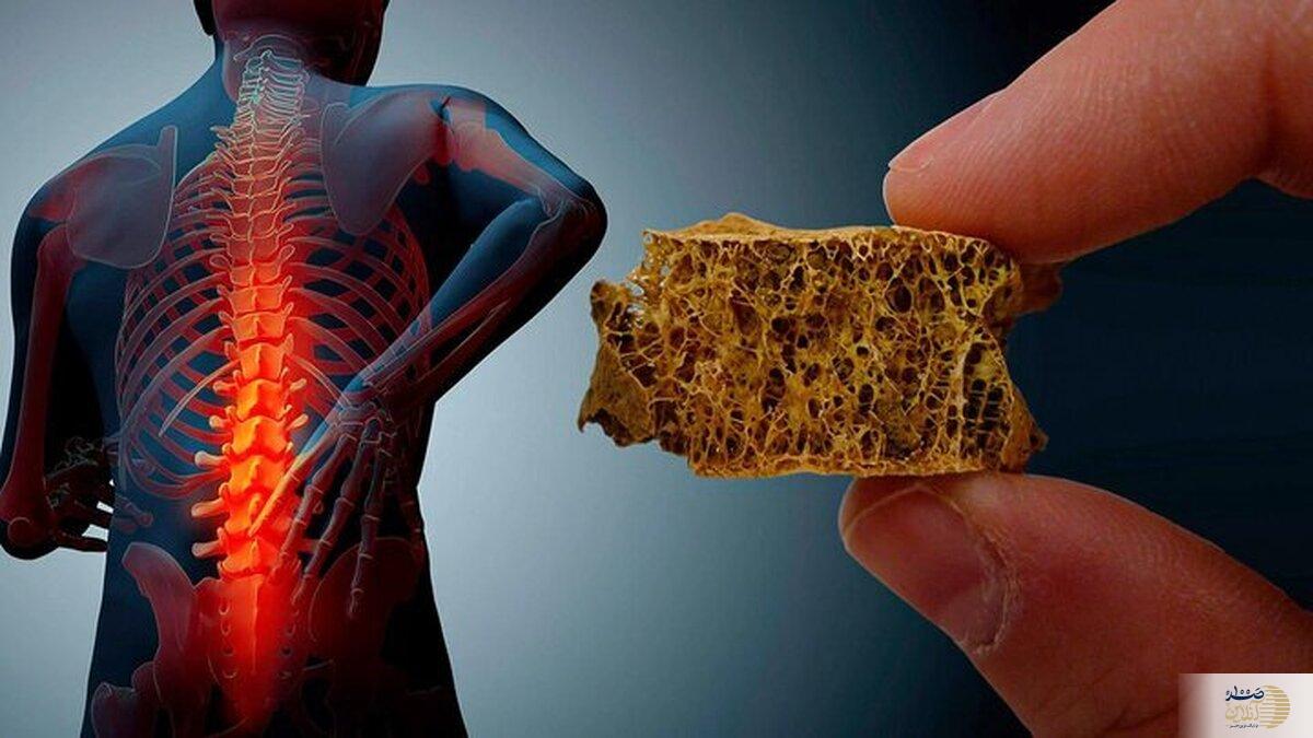 با این بیماری زنان زمین‌گیر می‌شوند